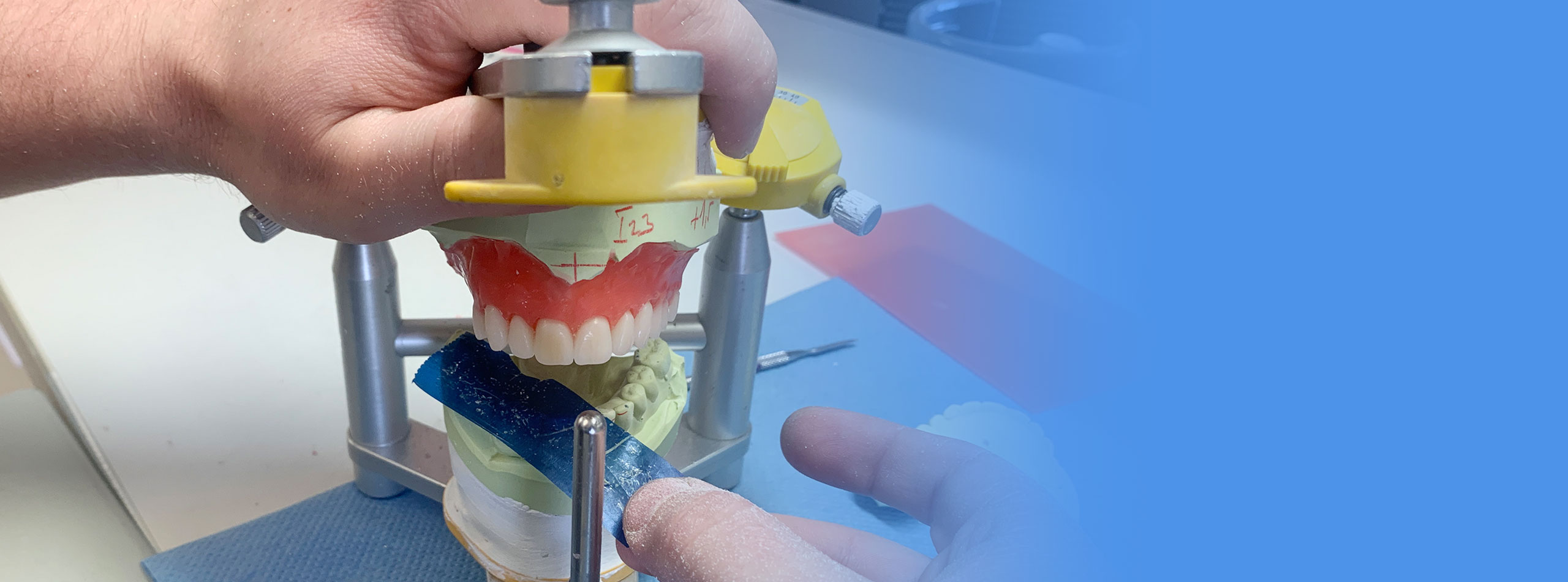 Wiedrich Dental Präzision